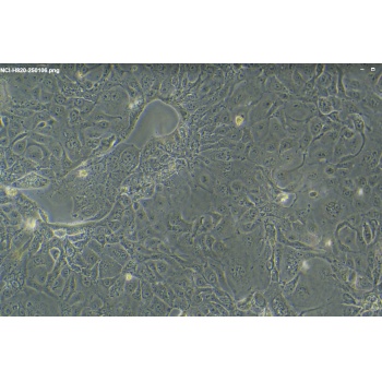 NCI-H820 （人非小细胞肺癌细胞）