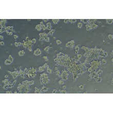 MDA-PCA-2B人前列腺癌细胞