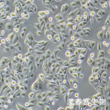 Nthyori 3-1（人甲状腺正常细胞）