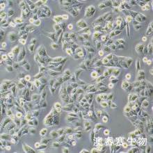 Nthyori 3-1（人甲状腺正常细胞）