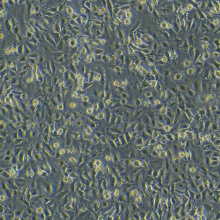 HC11（小鼠乳腺上皮细胞）