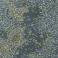 DL-40（人大细胞淋巴瘤）