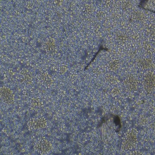 DL-40（人大细胞淋巴瘤）