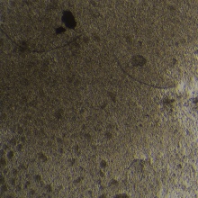 DL-40（人大细胞淋巴瘤）