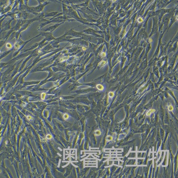 人正常肝细胞永生化