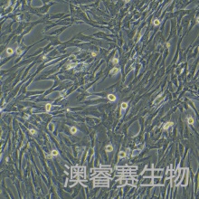 人正常肝细胞永生化