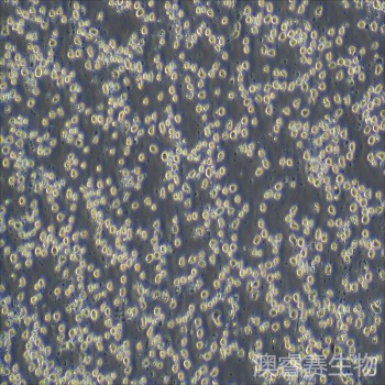 KO52（人白血病细胞）