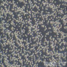 KO52（人白血病细胞）