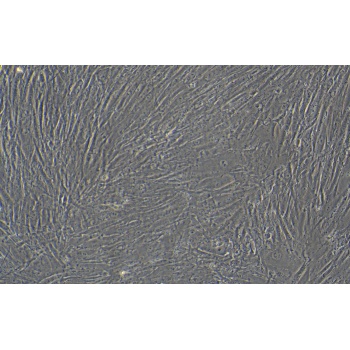 人主动脉瓣膜间质细胞