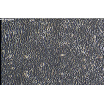 HTMC 人眼小梁网细胞