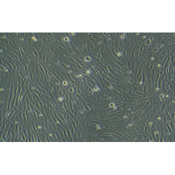 hcpepic;人脉络丛上皮细胞永生化