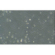 MCF 10A（人正常乳腺上皮细胞）