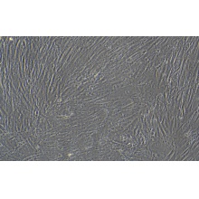 人主动脉瓣膜间质细胞