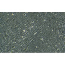 hcpepic;人脉络丛上皮细胞永生化