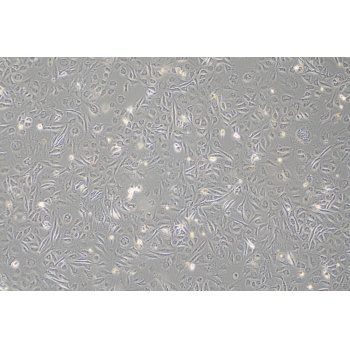 HUH-28人胆管癌细胞