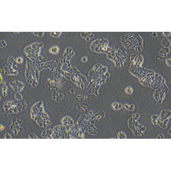 HCC202（人乳腺原发性导管癌）