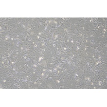 HUH-28人胆管癌细胞