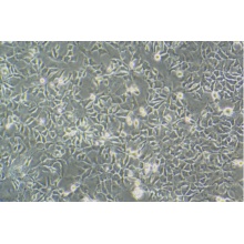 Hep3B-LUC（人肝癌细胞-荧光素酶标记）