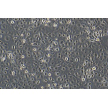 HCoEpiC（人正常结肠上皮细胞）