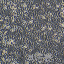 SNU668（人胃癌细胞）