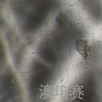 ECC12（人胃癌细胞）