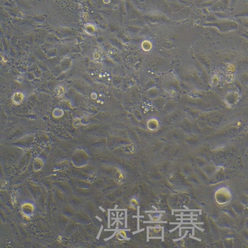 SNU878（人肝癌细胞）