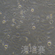 SNU878（人肝癌细胞）