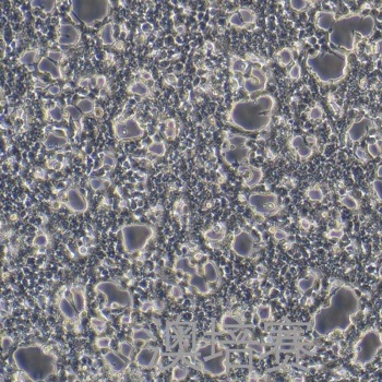 Phoenix-ECO（人逆转录病毒包装细胞）