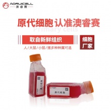 人宫颈癌成纤维细胞永生化