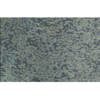 LUVA 细胞， 永生化人肥大细胞系