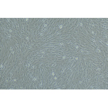 人真皮毛乳头细胞永生化