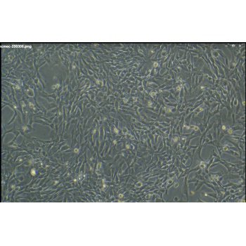 人心脏微血管内皮细胞永生化