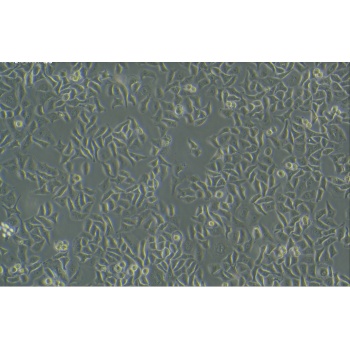 HCEC-B4G12（人角膜内皮细胞）