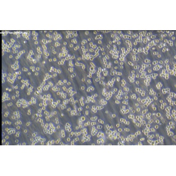 SHP-77-LUC（人小细胞肺癌细胞荧光素酶标记）