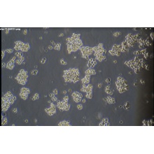 SHP-77 人小细胞肺癌细胞
