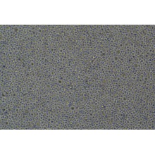 SET-2（成人急性巨核细胞白血病细胞）