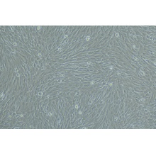 人真皮毛乳头细胞永生化