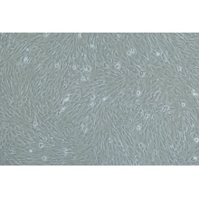 人真皮毛乳头细胞永生化