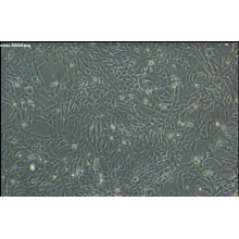 人心脏微血管内皮细胞永生化